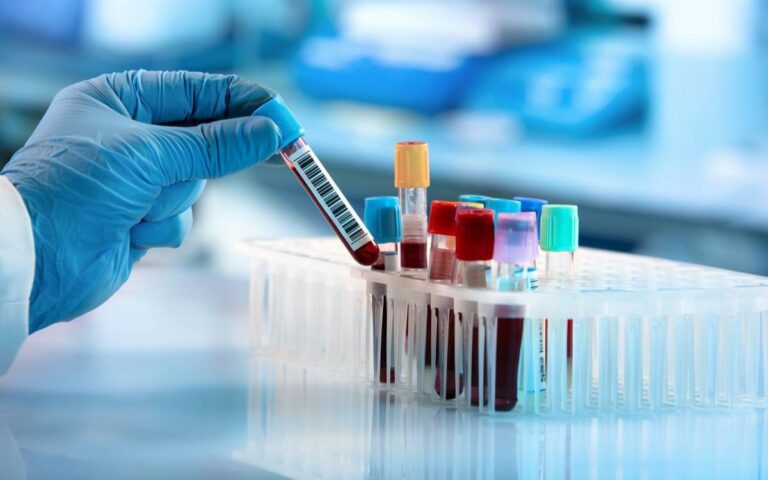 hi_res_blood_test_samples_1200x750-59cd6b99366c6e716576ccd68351ed39_desktop_x-1200x1200-1.jpg